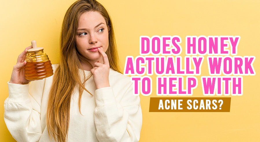 how to get rid of acne scars naturally with honey